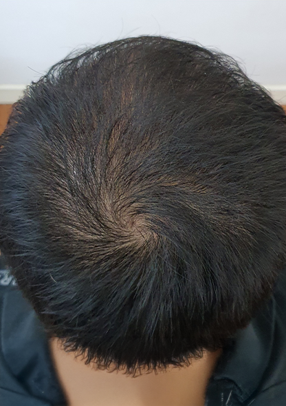 Dr. Joshua Chong2 - After