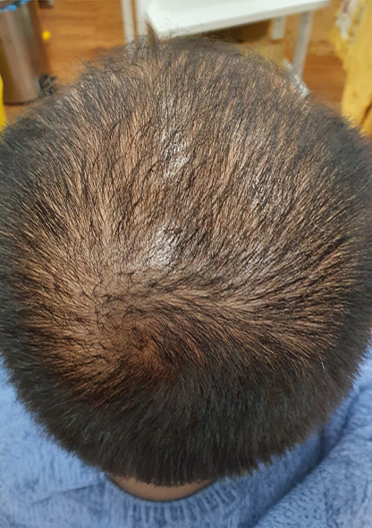 Dr. Joshua Chong2 - Before
