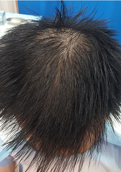 Dr. Joshua Chong - Before