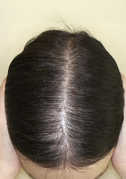 Dr. Joshua Chong 2 es - After
