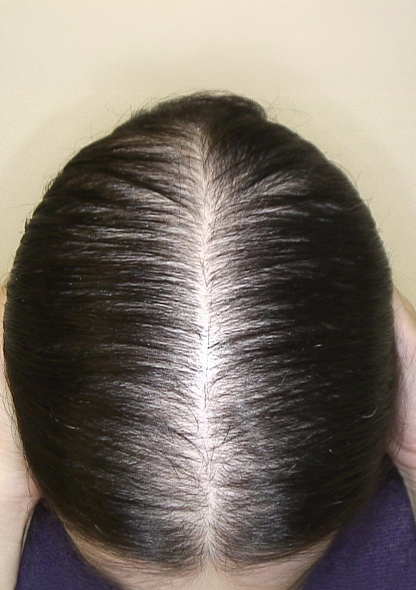 Dr. Joshua Chong 2 es - Before