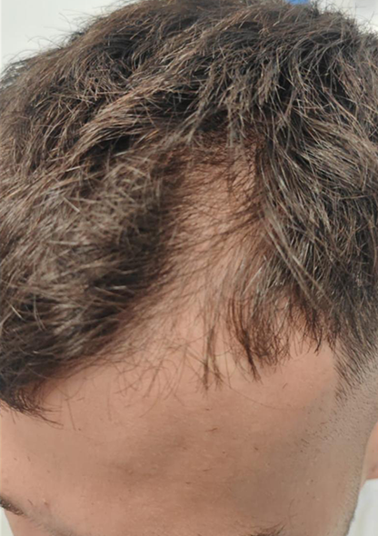 Dr. Joshua Chong es - Before