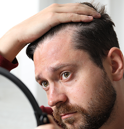 Traction Alopecia